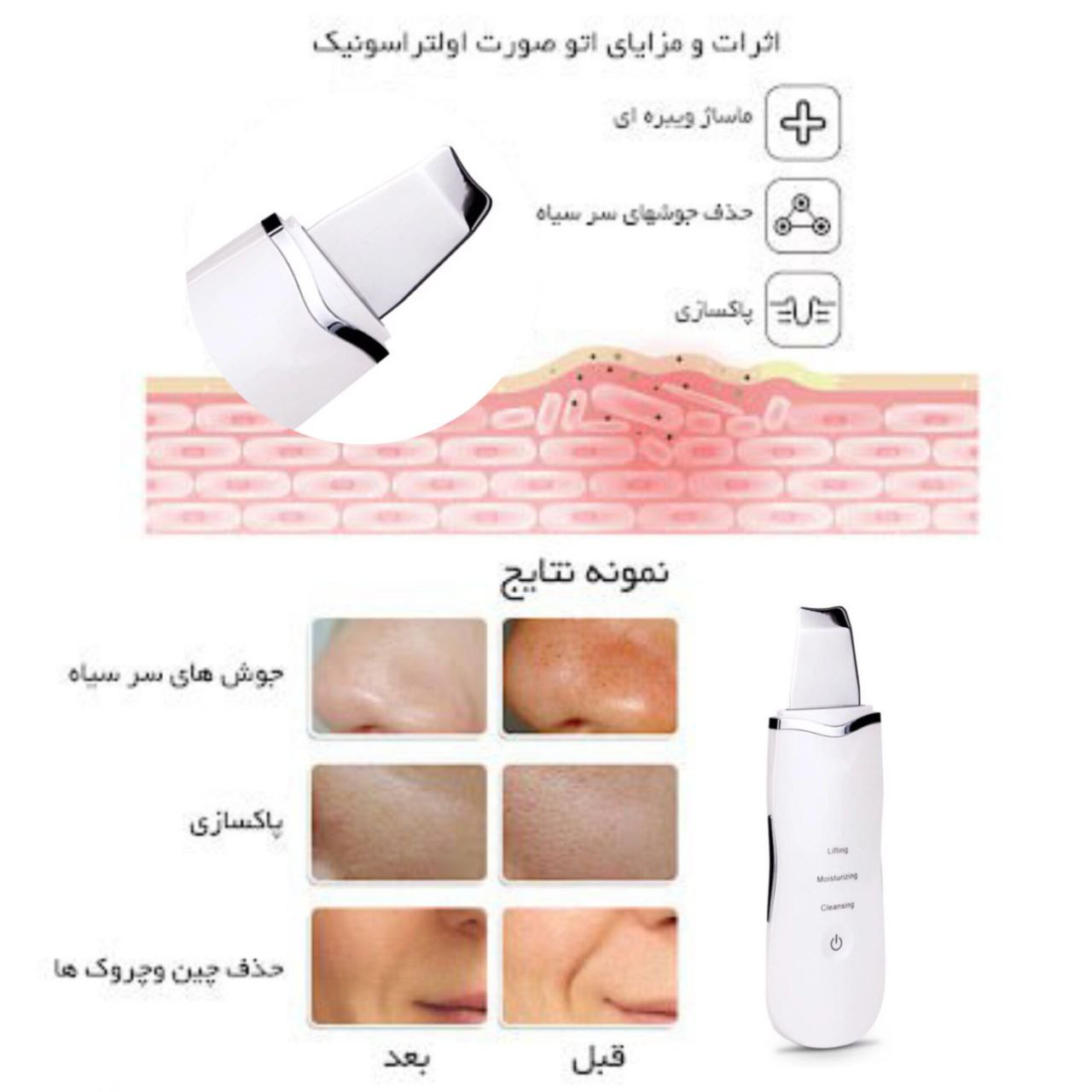 اتوی صورت مدل 8815 - تصویر 5